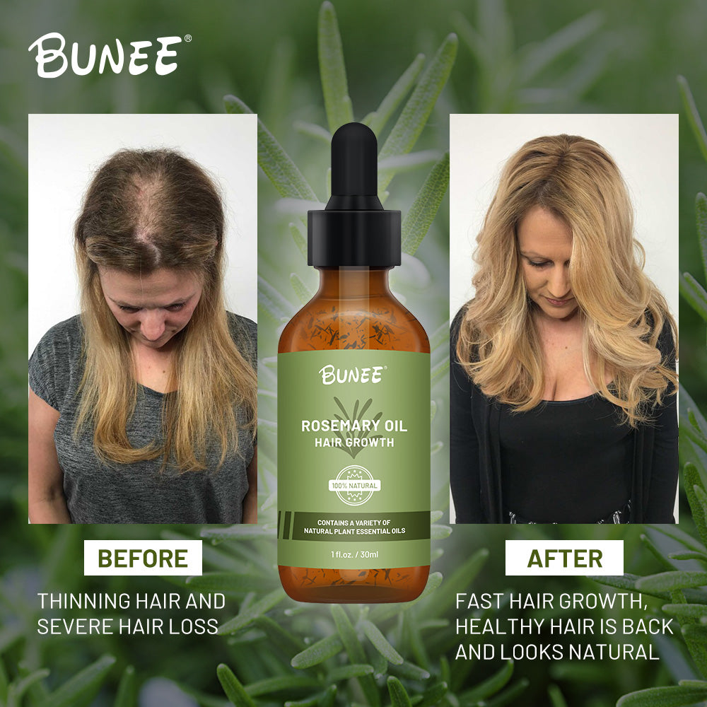 BUNEE Rosemary Hair Growth Serum Oil 30 ML(Pack of 2/3)